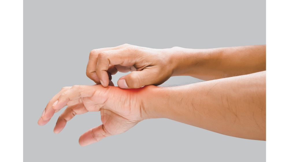 虫刺されのかゆみが止まらない人必見｜対処法やぶり返す可能性はある？