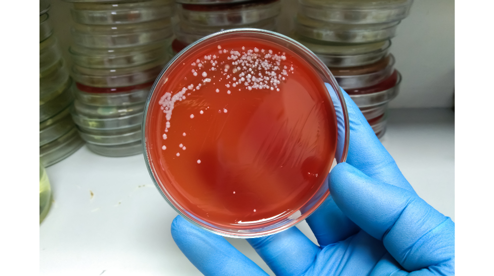 【うつる病気】子供から大人まで気をつけてほしい溶連菌感染症の症状や治療について